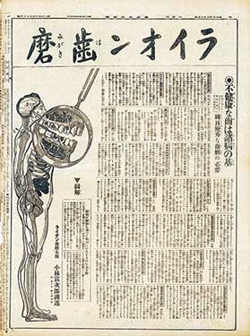 人体解剖図でむし歯の悪影響を表現した新聞広告（『東京日日新聞』1917年2月12日付）