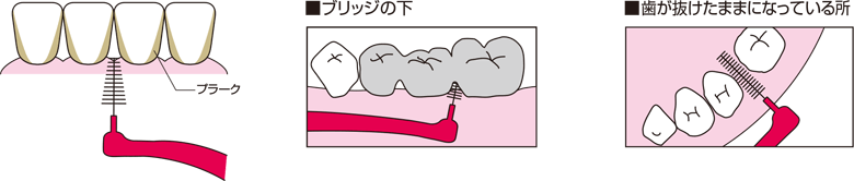 歯間ブラシの使用部位