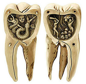 ワームの伝説を表した歯のオブジェ。18世紀につくられたもの（画／小堀文彦）