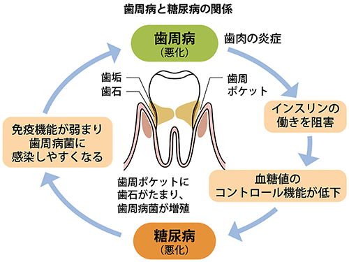 歯周病と糖尿病の関係　歯周病（悪化）→インスリンの働きを阻害→血糖値のコントロール機能が低下→糖尿病（悪化）→免疫機能が弱まり歯周病菌に感染しやすくなる→歯周病（悪化）