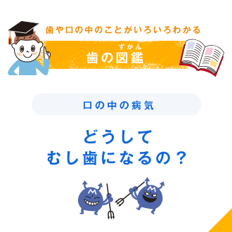 歯や口の中のことがいろいろわかる 歯の図鑑（ずかん） 口の中の病気 どうしてむし歯になるの？