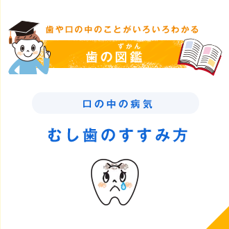 歯や口の中のことがいろいろわかる 歯の図鑑（ずかん） 口の中の病気 むし歯のすすみ方