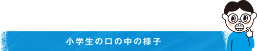 小学生の口の中の様子