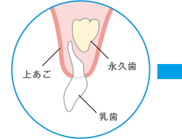 上あご 永久歯 乳歯