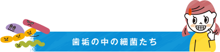 歯垢の中の細菌たち