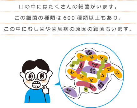 口の中にはたくさんの細菌がいます。この細菌の種類は600種類以上もあり、この中にむし歯や歯周病の原因の細菌もいます。