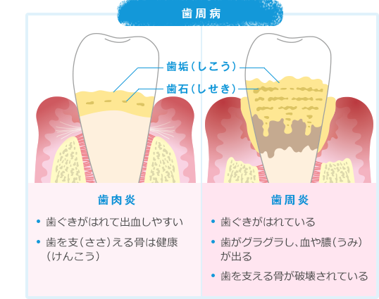 歯の図鑑 ずかん 小学生のみなさんへ 小学生歯みがき研究サイト 歯みがkids