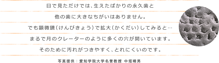 目で見ただけでは、生えたばかりの永久歯と他の歯に大きなちがいはありません。でも顕微鏡（けんびきょう）で拡大（かくだい）してみると…まるで月のクレーターのように多くの穴が開いています。そのために汚れがつきやすく、とれにくいのです。 写真提供：愛知学院大学名誉教授 中垣晴男
