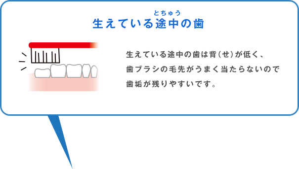 生えている途中の歯 生えている途中の歯は背（せ）が低く、歯ブラシの毛先がうまく当たらないので歯垢が残りやすいです。