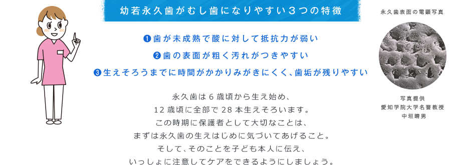 幼若永久歯がむし歯になりやすい３つの特徴