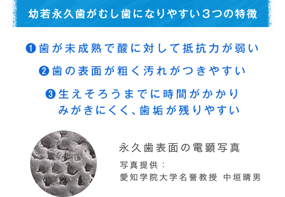 幼若永久歯がむし歯になりやすい３つの特徴