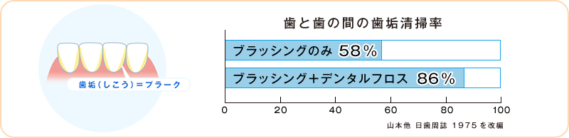 歯と歯の間の歯垢清掃率