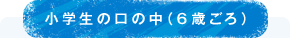 小学生の口の中（6歳ごろ）