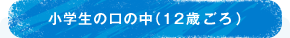 小学生の口の中（12歳ごろ）