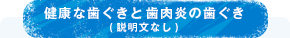 健康な歯ぐきと歯肉炎の歯ぐき(説明文なし)