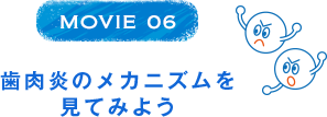 MOVIE 06 歯肉炎のメカニズムを見てみよう