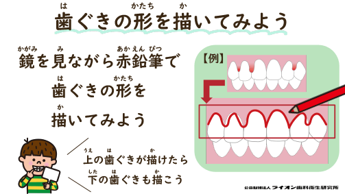 歯ぐきの形を描いてみよう