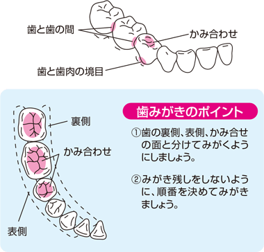 歯みがきのポイント 1：歯の裏側、表側、かみ合わせの面と分けてみがくようにしましょう。 2：みがき残しをしないように、順番を決めてみがきましょう。