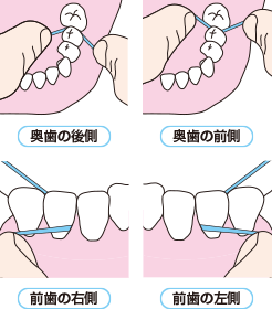 奥歯の後側 奥歯の前側 前歯の右側 前歯の左側