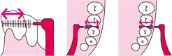 歯間ブラシを水平にして、歯面に沿わせて2～3回往復させて清掃します。奥歯は内側と外側からの両方向から使うと効果的です。