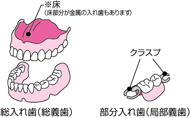 入れ歯 義歯 のケア方法 歯と口の健康研究室 ライオン歯科衛生研究所