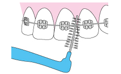 歯間ブラシ