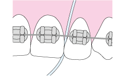 デンタルフロス