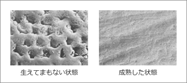 永久歯表面の電子顕微鏡写真