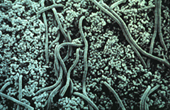 プラークの電子顕微鏡写真