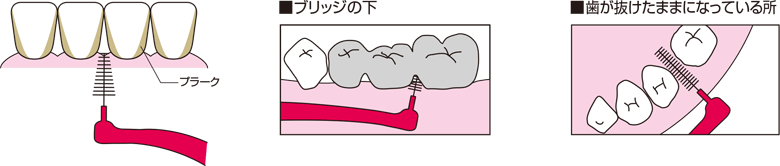 歯間ブラシ 歯と口の健康研究室 ライオン歯科衛生研究所