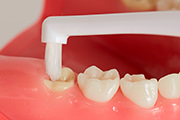 生えかわり期の生えている途中の歯