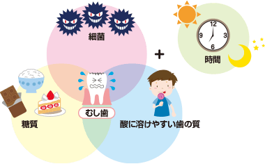 むし歯 歯と口の健康研究室 ライオン歯科衛生研究所