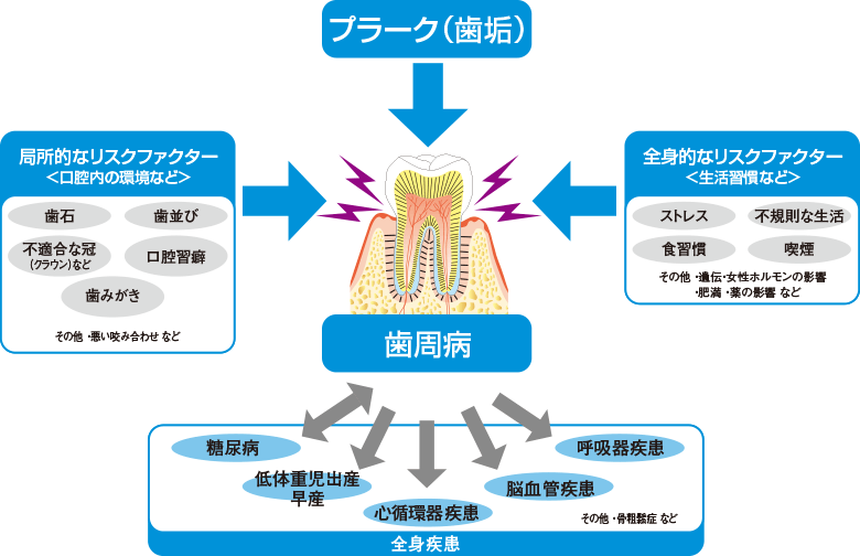 歯周病のリスクファクター