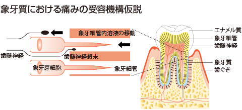 象牙質における痛みの受容機構仮説