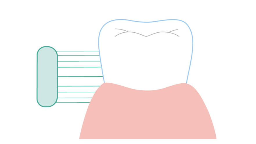 歯ブラシのあて方